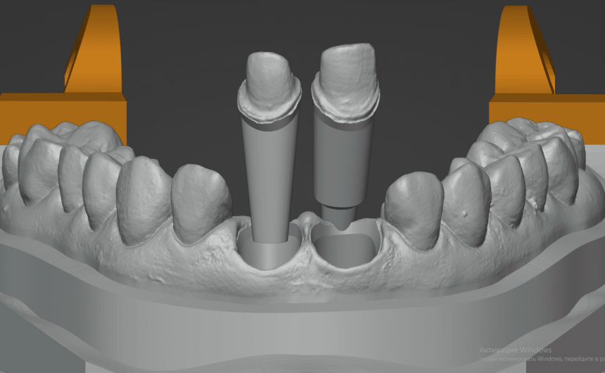 Slide 2